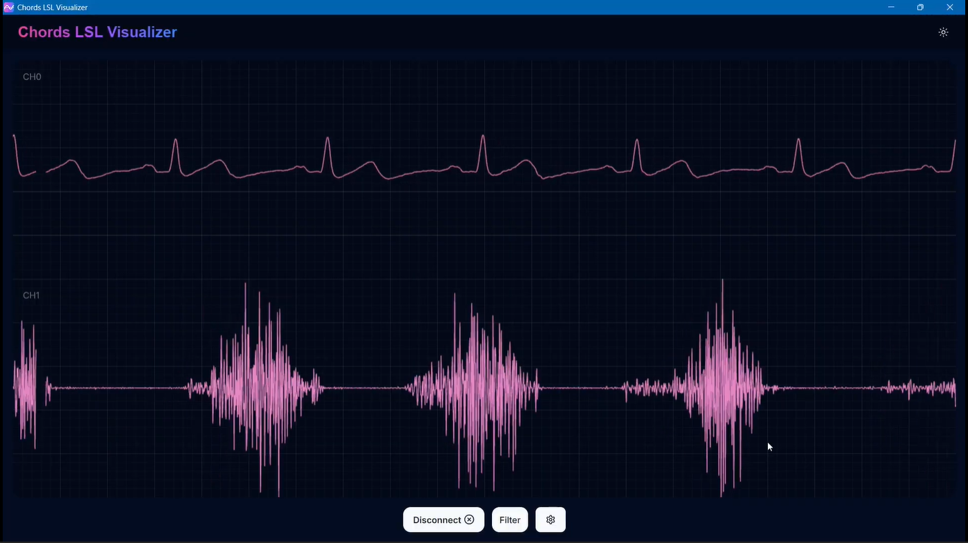 Real-time Signal Visualisation